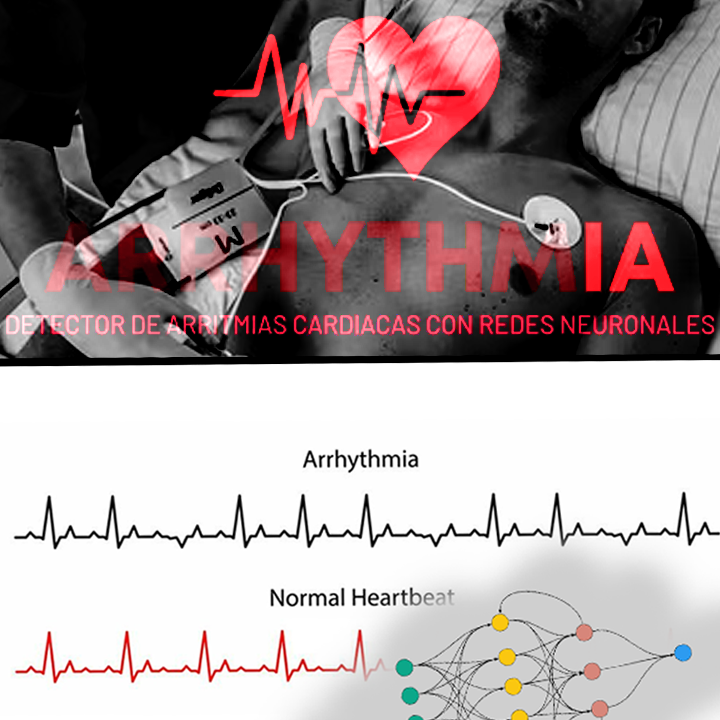 Arrhythmia Detector with AI